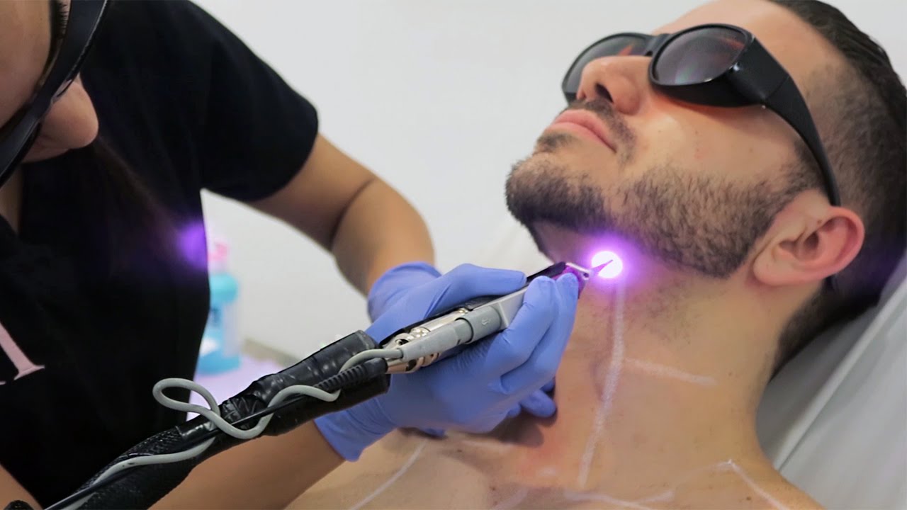 Laser Hair Removal For Man Derma Laser Clinic